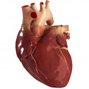 Boli cardiovasculare (2)